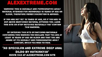 Play XO speculum and extreme deep anal dildo by Hotkinkyjo